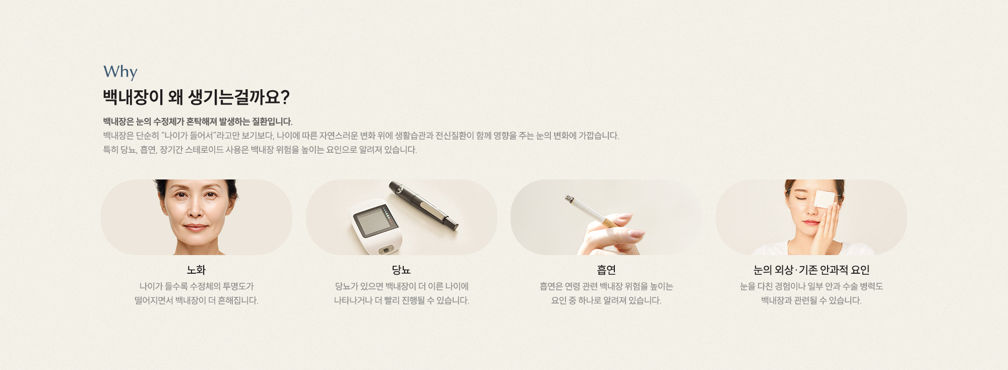 백내장이 왜 생기는걸까요? 노화 당뇨 흡연 눈의 외상·기존 안과적 요인