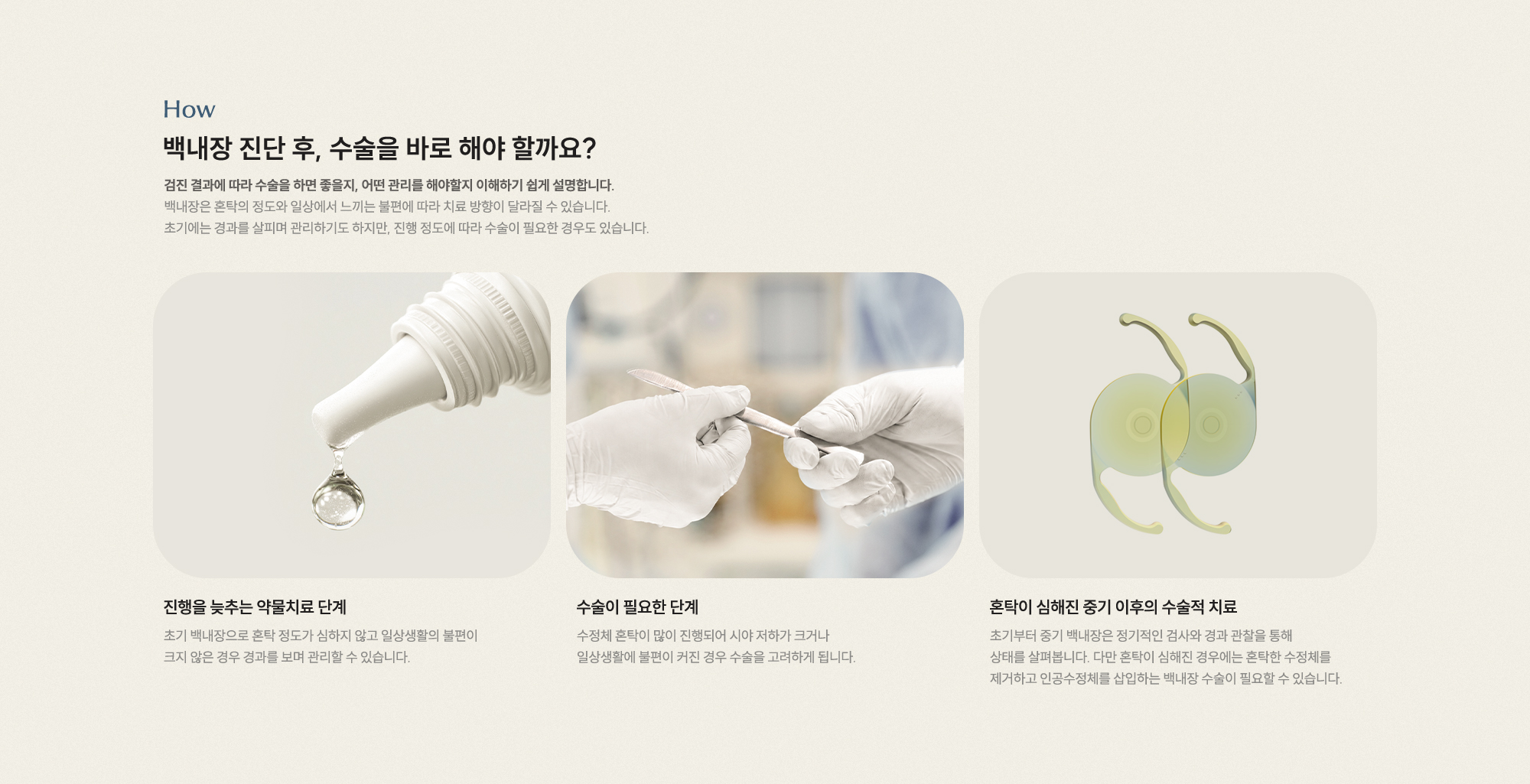 백내장 진단 후, 수술을 바로 해야 할까요? 검진 결과에 따라 수술 여부와 관리 방법을 이해하기 쉽게 설명합니다.