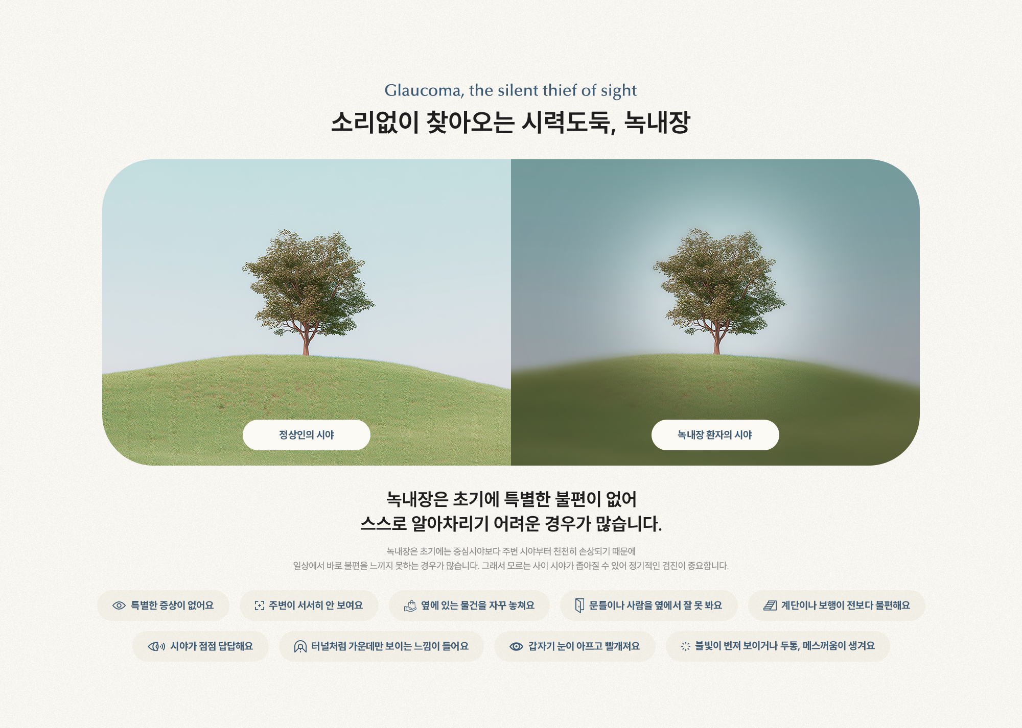 소리없이 찾아오는 시력도둑, 녹내장 녹내장은 초기에 특별한 불편이 없어 스스로 알아차리기 어려운 경우가 많습니다.
