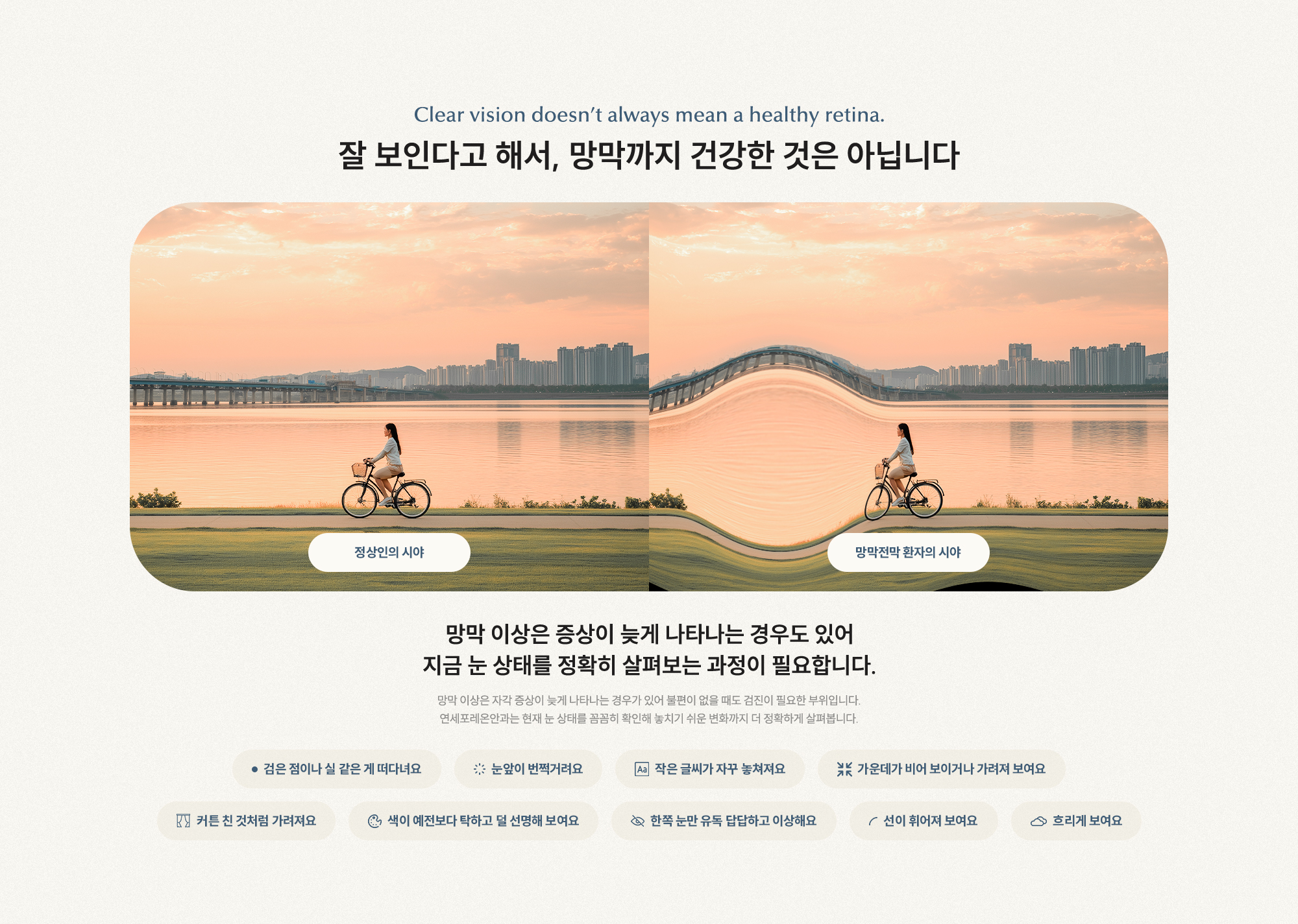 잘 보인다고 해서, 망막까지 건강한 것은 아닙니다 망막 이상은 증상이 늦게 나타나는 경우도 있어 지금 눈 상태를 정확히 살펴보는 과정이 필요합니다.