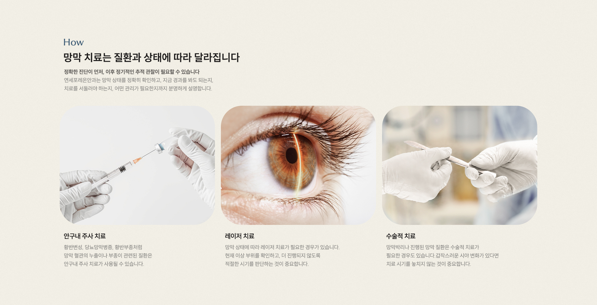 망막 치료는 질환과 상태에 따라 달라집니다. 정확한 진단이 먼저, 이후 정기적인 추적 관찰이 필요합니다.