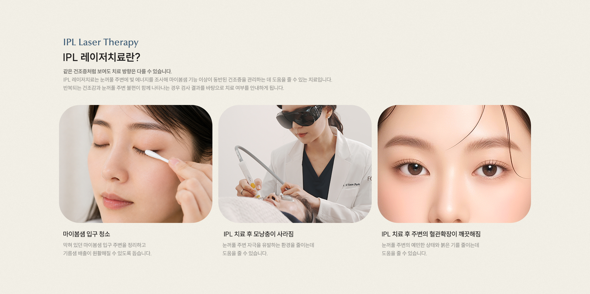 IPL 레이저치료란? 마이봄샘 기능 이상이 동반된 건조증 관리에 도움을 줄 수 있는 치료입니다. 마이봄샘 입구 청소 IPL 치료 후 모낭충 사라짐 혈관확장 개선